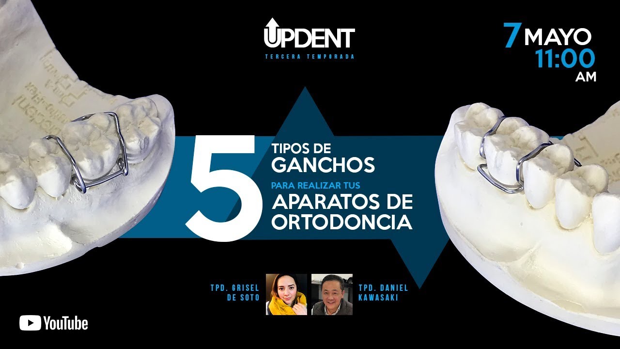 Posici n Chasquido Construcci n Naval Ganchos Retenedores Ortodoncia posici-n-chasquido-construcci-n-naval-ganchos-retenedores-ortodoncia
