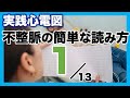 【心電図 読み方 ①】不整脈の読み方 心室性期外収縮