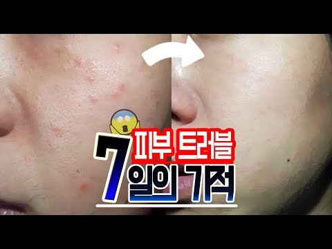 피부유산균