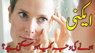 Acne Hona ki Waja Kya Hoskty Hain |#HomeRemedies #FriendsHealthcare