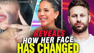 Jasmine Pineda Reveals Facial Bruise After Emergency Surgery | 90DF Star's Postpartum Struggle