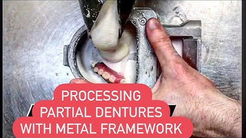 PARTIAL DENTURE PROCESSING #WAXBAE #DENTURE #PARTIALDENTURES