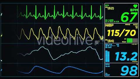 After Effects project - EKG Display Monitor