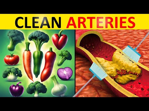 Top 7 Vegetables To Clean Arteries And Prevent Heart Attacks