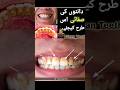 دانتوں کی صفائی اس طرح کیجئے 