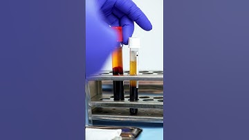 Platelet Rich Fibrin (PRF) - Watch the Process