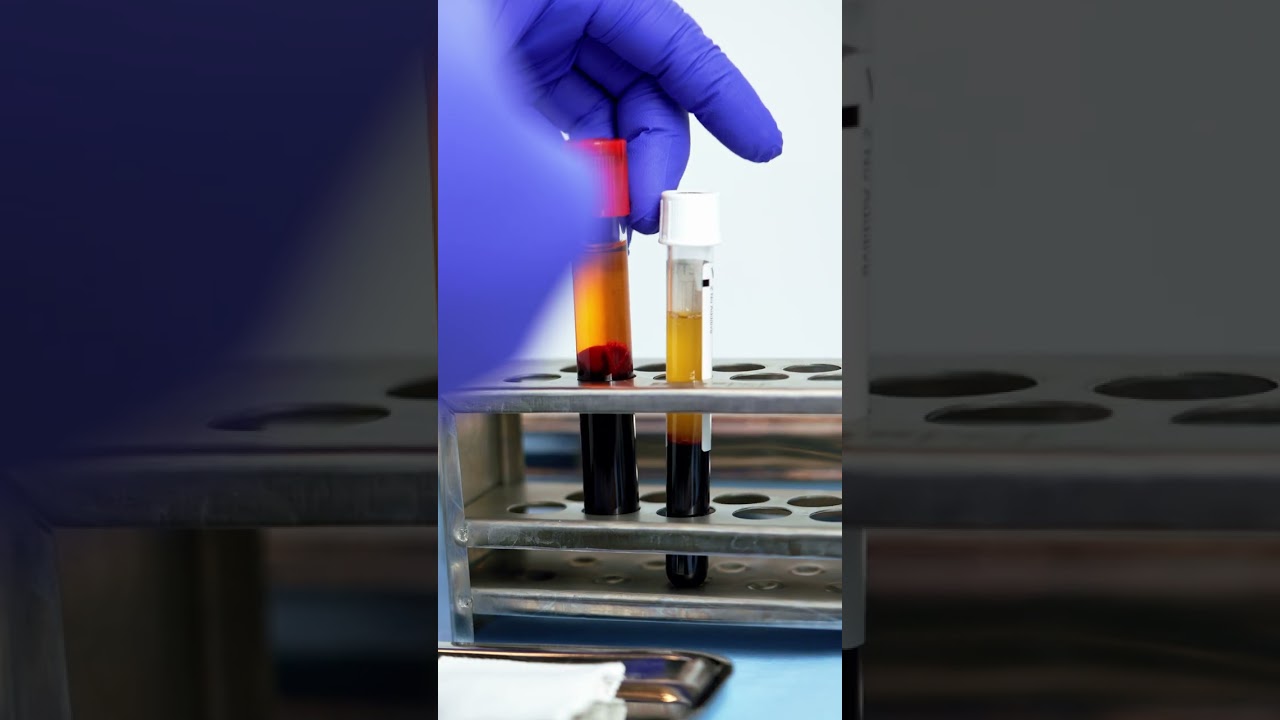 Platelet Rich Fibrin (PRF) - Watch the Process