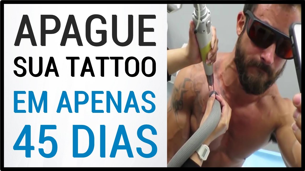 Como Remover Tatuagem Naturalmente do Corpo Sem Laser (Definitiva) YouTube Como Remover Tatuagem Naturalmente do Corpo Sem Laser (Definitiva) YouTube