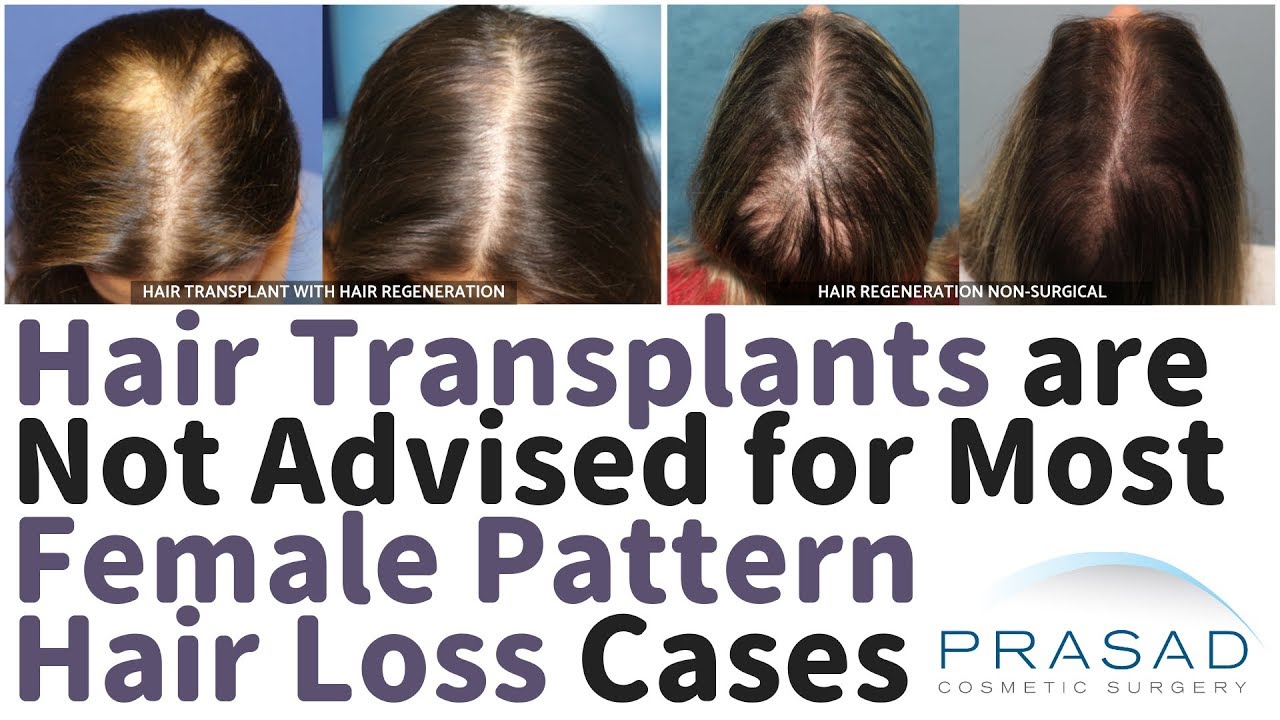 Towards a consensus on how to diagnose and quantify female pattern hair loss   The Female Pattern Hair Loss Severity Index FPHLSI  Harries  2016   Journal of the European Academy