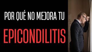 Epicondilitis. Tratamiento