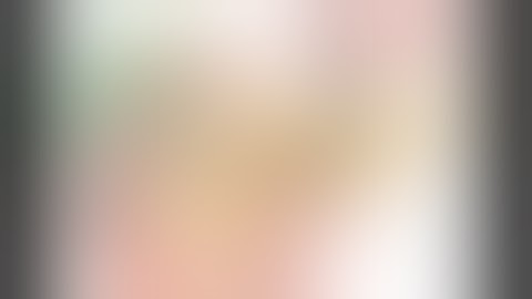 DIFFICULT ERCP— PERIAMPULLARY DIVERTICULUM, CBD STRICTURE, MECHANICAL LITHOTRIPSY