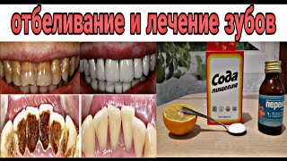 Супер эффект👍/ Отбеливание зубов, восстановление десен, Удаление зубной камень, Удаление запаха рта