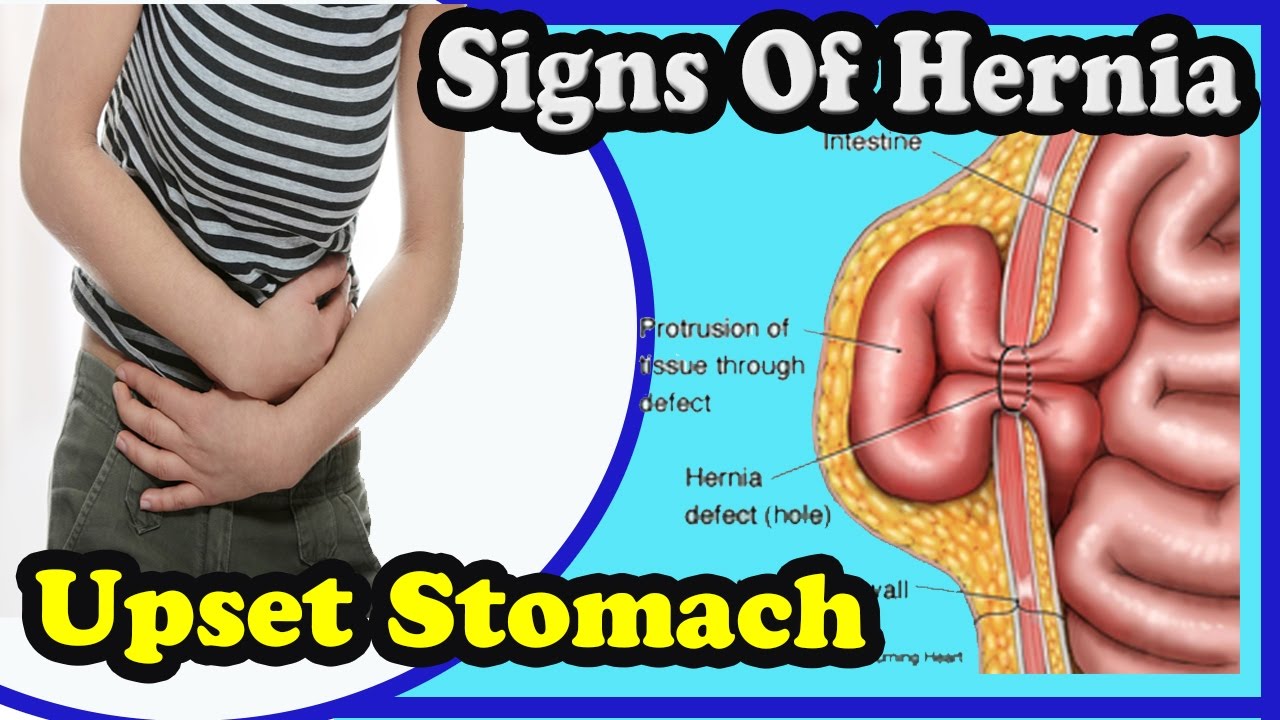 signs of hernia