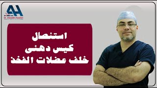 استئصال كيس دهنى خلف عضلات الفخذ