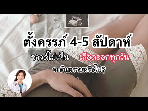 วีดีโอ: วิธีระบุการตั้งครรภ์ที่ไม่ได้รับ
