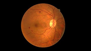A new generation of artificial retinas based on 2D materials
