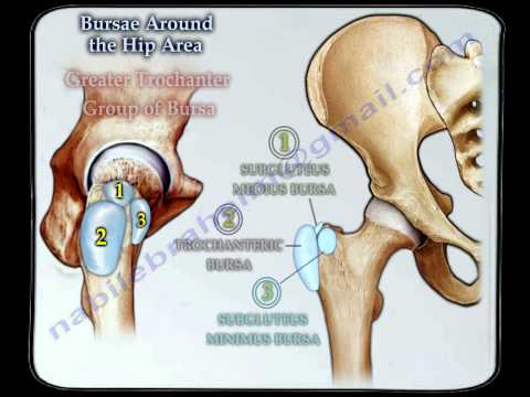 Bursitis  Around The Hip - Everything You Need To Know - Dr. Nabil Ebraheim