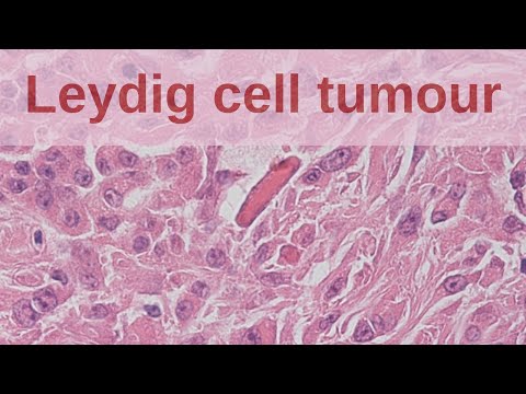 Video: Tumor Ya Tezi Dume (Leydig Cell) Katika Mbwa