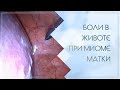 Боли в животе при миоме матки