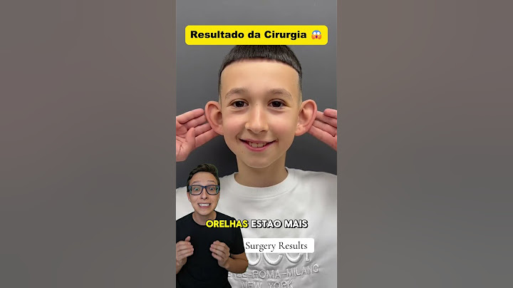 Orelha de Abano 😱 #medicina #medico #enfermagem #enfermeiro  #plástica #cirurgiaplastica Otoplastia