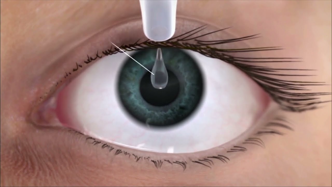 Systane® ULTRA SÄILITUSAINETA silmatilgad | Alcon Eesti