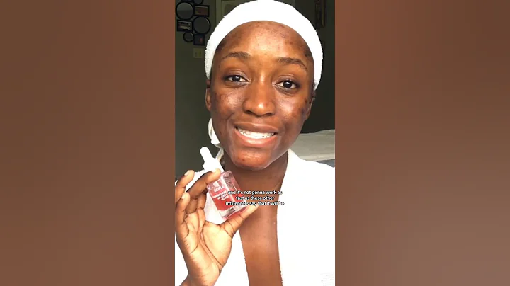 ANUA TXA SERUM BEFORE/AFTER [2 MONTH UPDATE ‼️] | TAHJAERA #darkspotcorrector