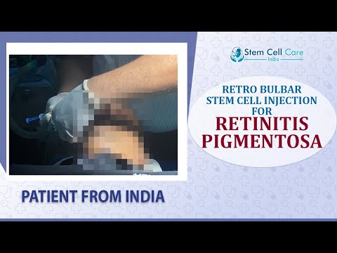 Patient With Retinitis Pigmentosa | exosome & stem cell injection for RP | Retro Bulbar Injection