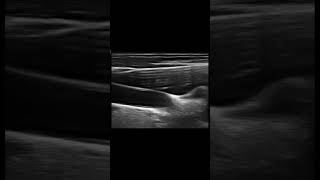 Flap ? Mirror artifact ! #Apache Net Worth