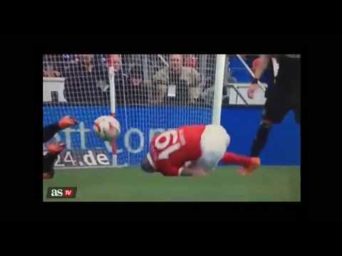 la peor lesion de la bundesliga