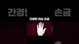 간에 문제가 있음을 알려주는 손금 #손금 #건강운