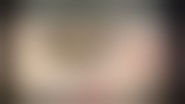 CataractCoach™1730: belt loop to fixate Ahmed segment