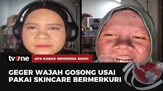 Cerita Nur Sha, Wajah 'Gosong' Terdampak Krim Merkuri | AKIS tvOne