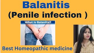 Balanitis (Penis Infection) Treatment !! Balanitis Symptoms, Causes & Homeopathic Medicine