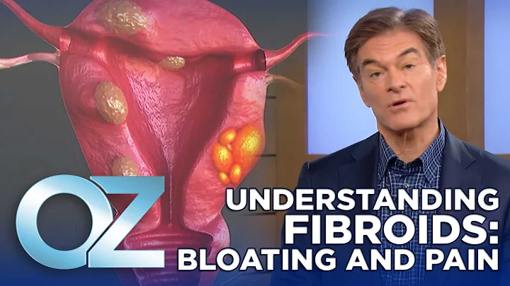 Are Your Fibroids Making You Bloated and Painful? Here's What You Need to Know | Oz Health