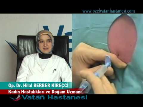 Epidural steroid injection lumbar video