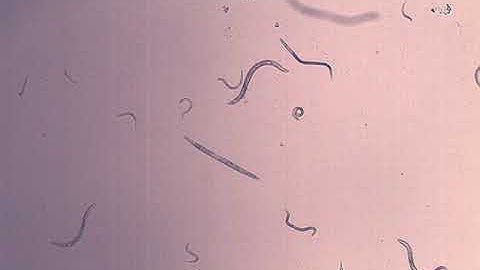 wild type C. elegans movement