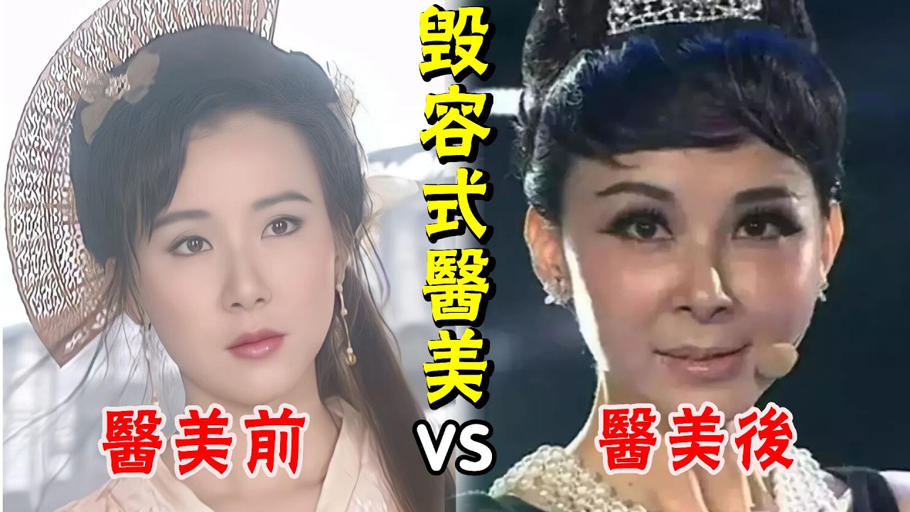 以為【退圈】實則被【醫美毀容】，這8位女星變得麵目全非，整容臉真的不堪一擊！#週揚#劉競#劉雨欣#何琳#蕭薔#文夢洋#姚芊羽#溫嵐