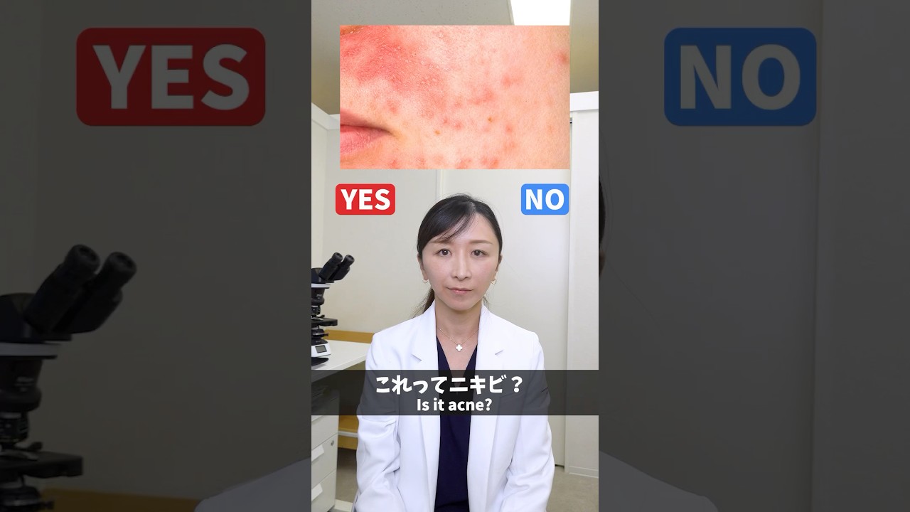 皮膚科医が教える】ニキビとよく間違えられる疾患 - YouTube