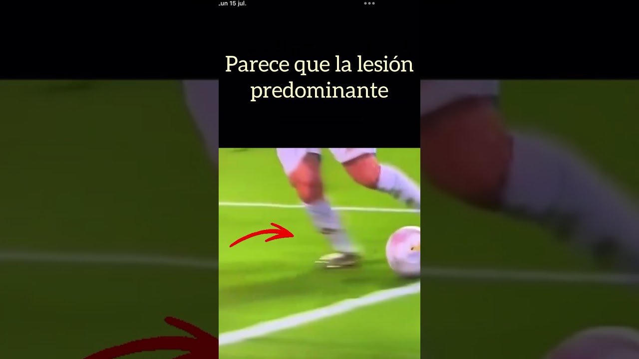 Esguince de tobillo de Leo Messi 