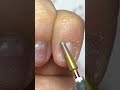 Video: Punta fresa cuticole, forma cono medio arrotondato, in diamante
