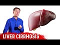 Is Liver Cirrhosis Reversible? -  Fibrosis vs. Cirrhosis – Dr.Berg