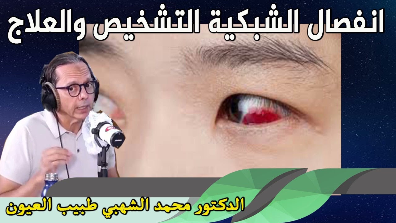 انفصال الشبكية التشخيص والعلاج الدكتور محمد الشهبي طبيب العيون