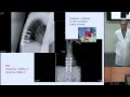 Spine Stabilization Techniques for Spine Tumors by Jens Chapman, M.D.