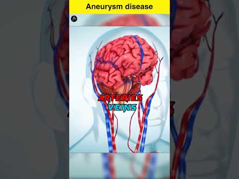 वीडियो: जॉनी हॉर्टन की मृत्यु कैसे हुई?