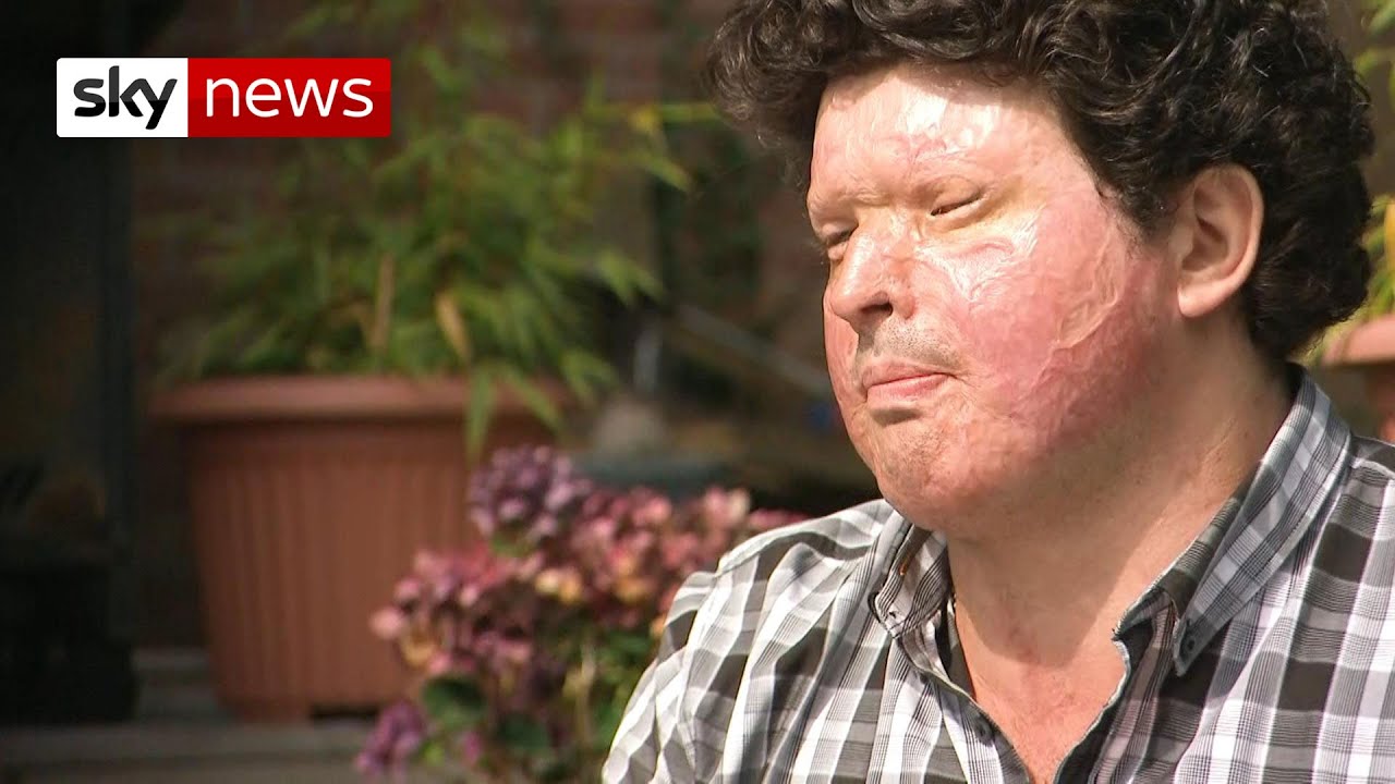 Acid victim 'sickened' after attacker's life sentence quashed YouTube