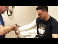 Getting My Cast Removed (my arm is stiff!)