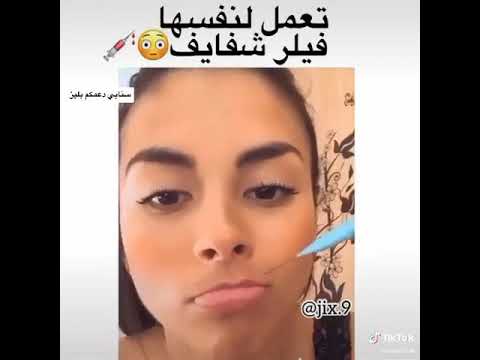 فتاه تحقن بنفسها شفايفها فيلر