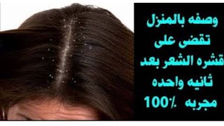 علاج قشرة وحكة الشعر للكبار والأطفال مع خبيرة التجميل نيڤين مندور