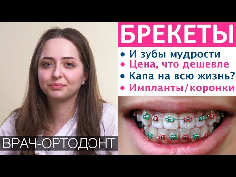 Брекеты - цена, капа и ретейнеры, установка брекетов с имплантам и коронками, брекеты на обе челюсти