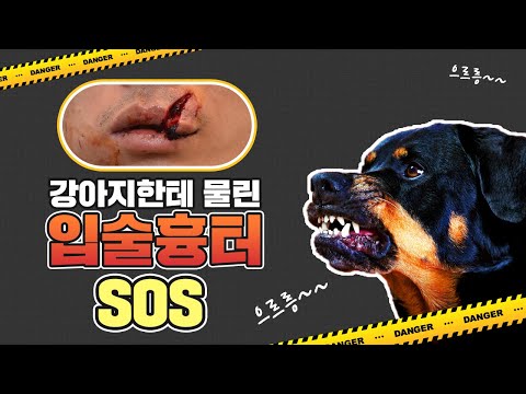 개에물렸을때🐶 응급실로 바로가야하나요?ㅣ대처 방법 어떻게?